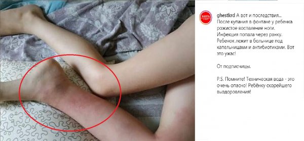 Послушай ЛДПР и сделай наоборот - Совет Жириновского отправил ребёнка в больницу
