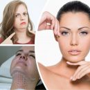 Я уколов не боюсь! 4 типа женщин, которым пора копить на филлеры для подбородка
